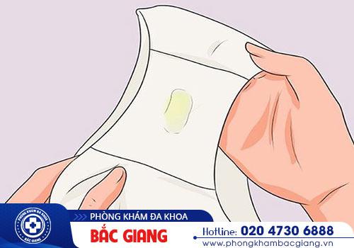 Âm đạo chảy mủ cần nhanh chóng thăm khám và hỗ trợ điều trị kịp thời