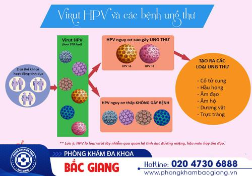 Bệnh HPV là gì? Tổng hợp những thông tin quan trọng nhất