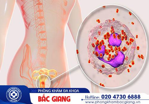 Bệnh lậu gây nên nhiều dấu hiệu và biến chứng nguy hiểm khi nữ giới mắc phải