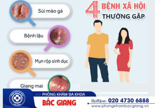 Các căn bệnh xã hội thường gặp hiện nay. chữa trị bệnh xã hội