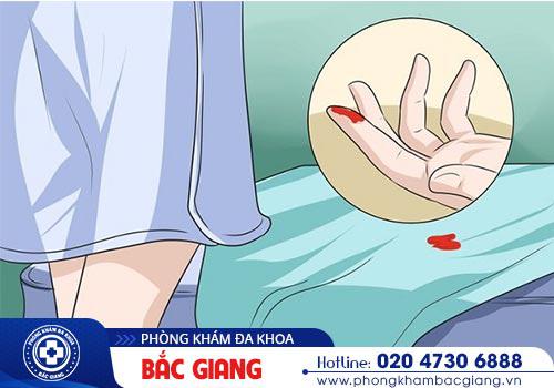 Cách chữa bệnh Chlamydia như thế nào? Địa chỉ chữa bệnh hiệu quả