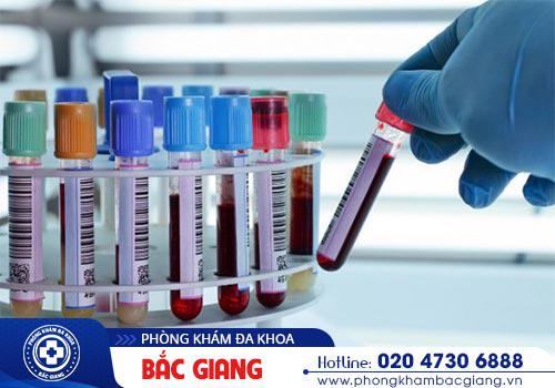 Chi phí xét nghiệm bệnh xã hội có mắc không? Là bao nhiêu?