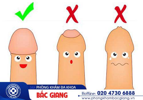 Các bệnh về bao quy đầu tăng nguy cơ viêm nhiễm nổi hạt ngọc dương vật