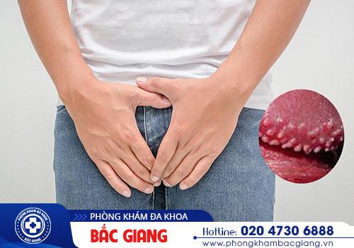 Hạt ngọc dương vật gây ảnh hưởng đến tâm lý của phái mạnh rất lớn