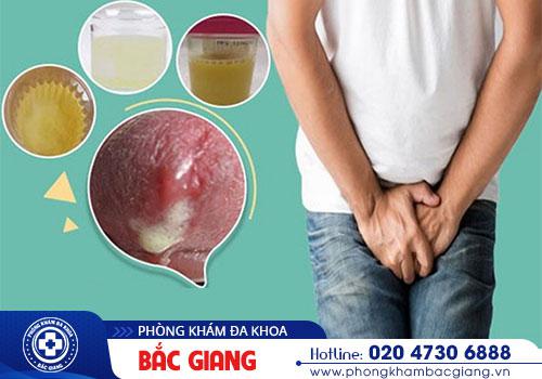 đái ra mủ đái ra mủ