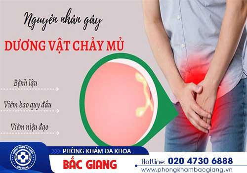 Dương vật chảy mủ - Cảnh giác với những bệnh lý nguy hiểm