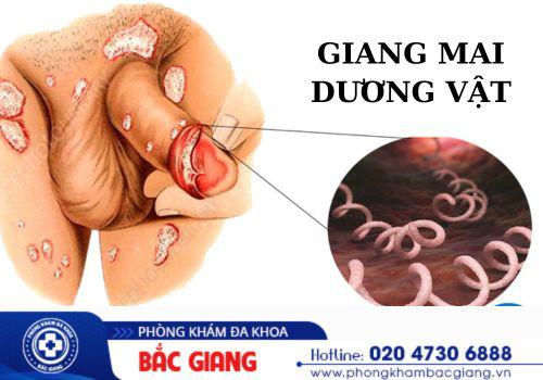 HÌnh ảnh bệnh giang mai dương vật. giang mai dương vật