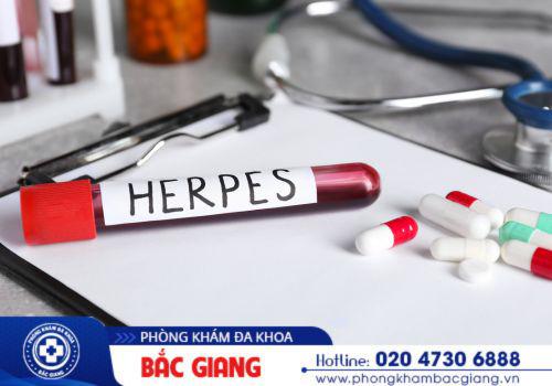 Herpes sinh dục là căn bệnh lây truyền qua đường tình dục. herpes sinh dục
