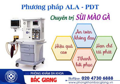 Phương pháp ALA – PDT cải tiến chữa trị sùi mào gà hiệu quả