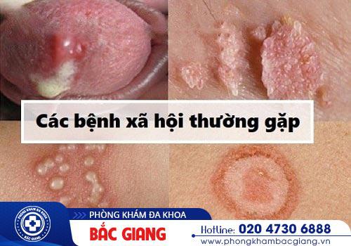 Khám bệnh xã hội ở đâu hiệu quả chất lượng tại Bắc Giang?