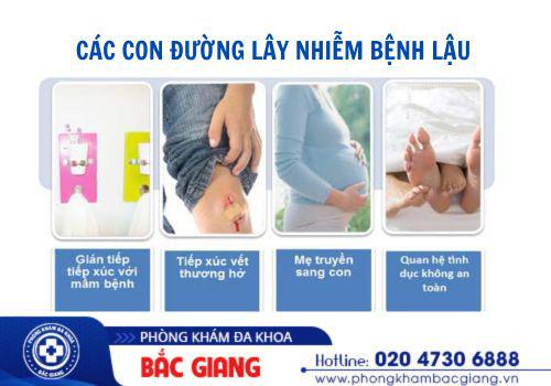 Các con đường lây nhiễm của bệnh lậu. bệnh lậu