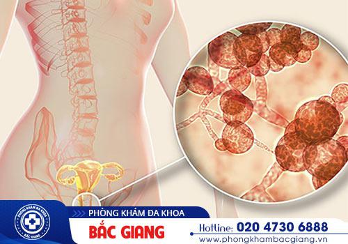 Chảy mủ vùng kín phần lớn do bệnh Lậu gậy nên