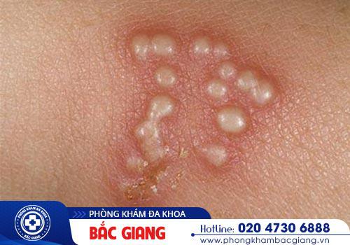 Nhận biết các dấu hiệu bệnh xã hội thường gặp