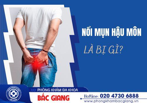 Nổi mụn hậu môn là bị gì? nổi mụn hậu môn