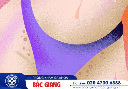Mụn vùng kín là lời cảnh báo cho nhiều bệnh xã hội nguy hiểm