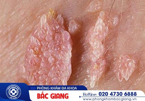 Phòng khám chữa bệnh xã hội an toàn chất lượng tại Bắc Giang