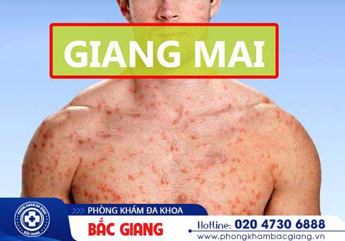 Phòng khám chữa bệnh xã hội an toàn chất lượng tại Bắc Giang