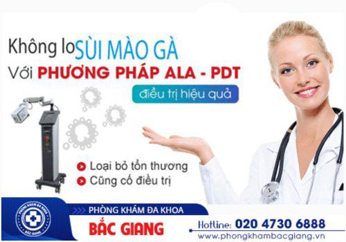 Chữa sùi mào gà bằng phương pháp ALA - PDT hiện đại. thuốc chữa sùi mào gà