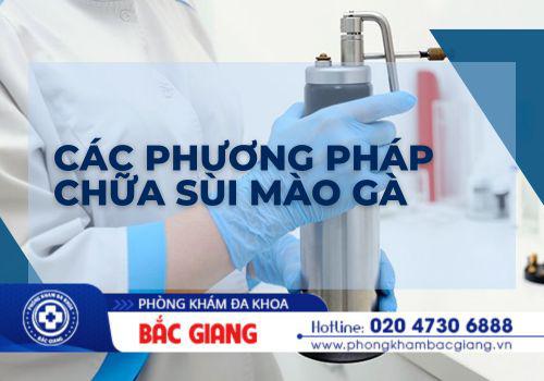 Các phương pháp chữa sùi mào gà được áp dụng hiện nay. các phương pháp chữa sùi mào gà