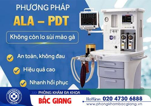 Phương pháp ALA – PDT cải tiến chữa trị sùi mào gà hiệu quả
