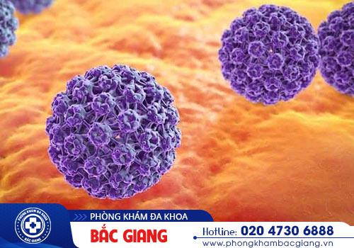Cần nhanh chóng thăm khám khi phát hiện dấu hiệu sùi mào gà