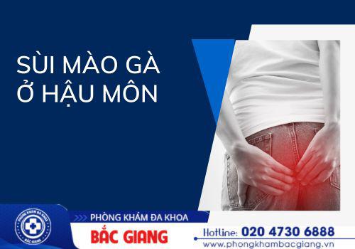 Sùi mào gà hậu môn có sao không? sùi mào gà hậu môn