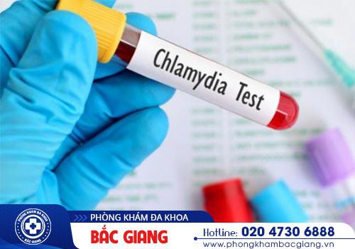Tổng hợp các thông tin cần biết về bệnh Chlamydia