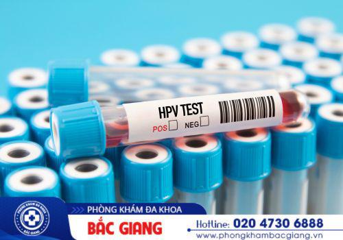 Các phương pháp xét nghiệm sùi mào gà. xét nghiệm bệnh sùi mào gà